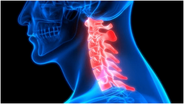 neck pain leads to back pain