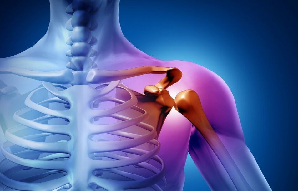 shoulder injury due to osteoarthritis