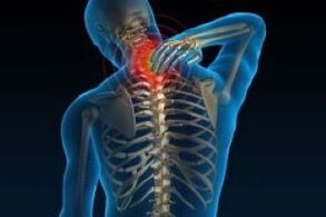 cervical osteochondrosis leads to neck tenderness