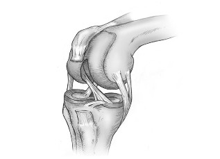 Difference between joint lesions